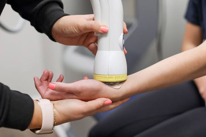 Carpal Tunnel Syndrome