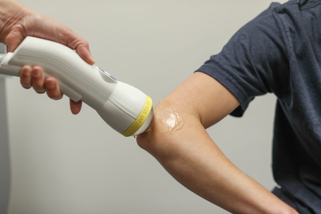 A modern SoftWave broad-focus applicator next to a traditional focused shockwave probe
