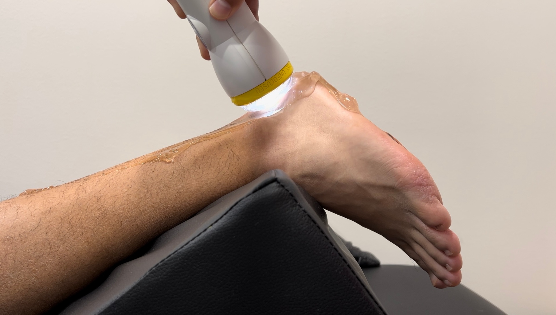 Achilles Tendonitis