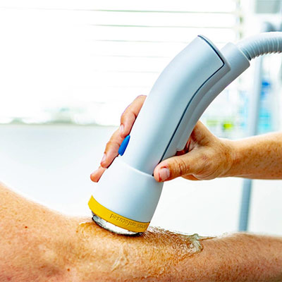 SoftWave Tissue Regeneration Therapy in action
